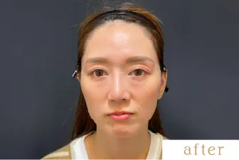 After