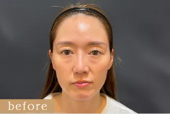 Before